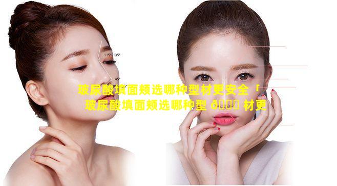 玻尿酸填面颊选哪种型材更安全「玻尿酸填面颊选哪种型 🐛 材更安全一些」